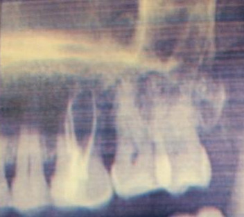 soins dentaires dentiste ormesson la varenne 94