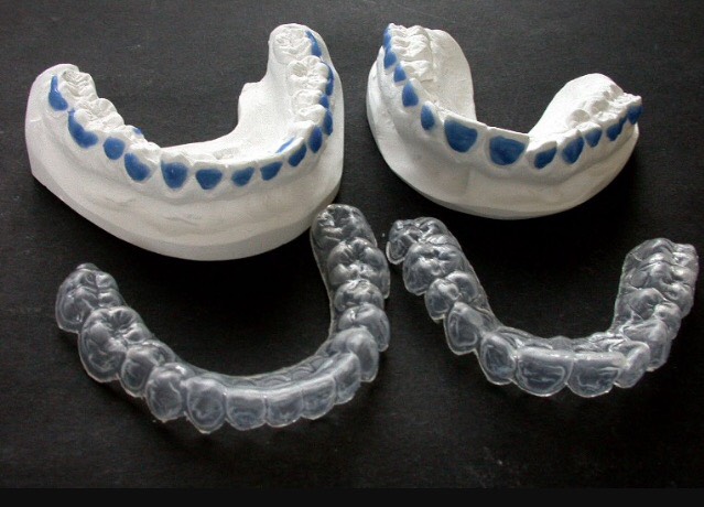 gouttieres dentiste la varenne saint hilaire