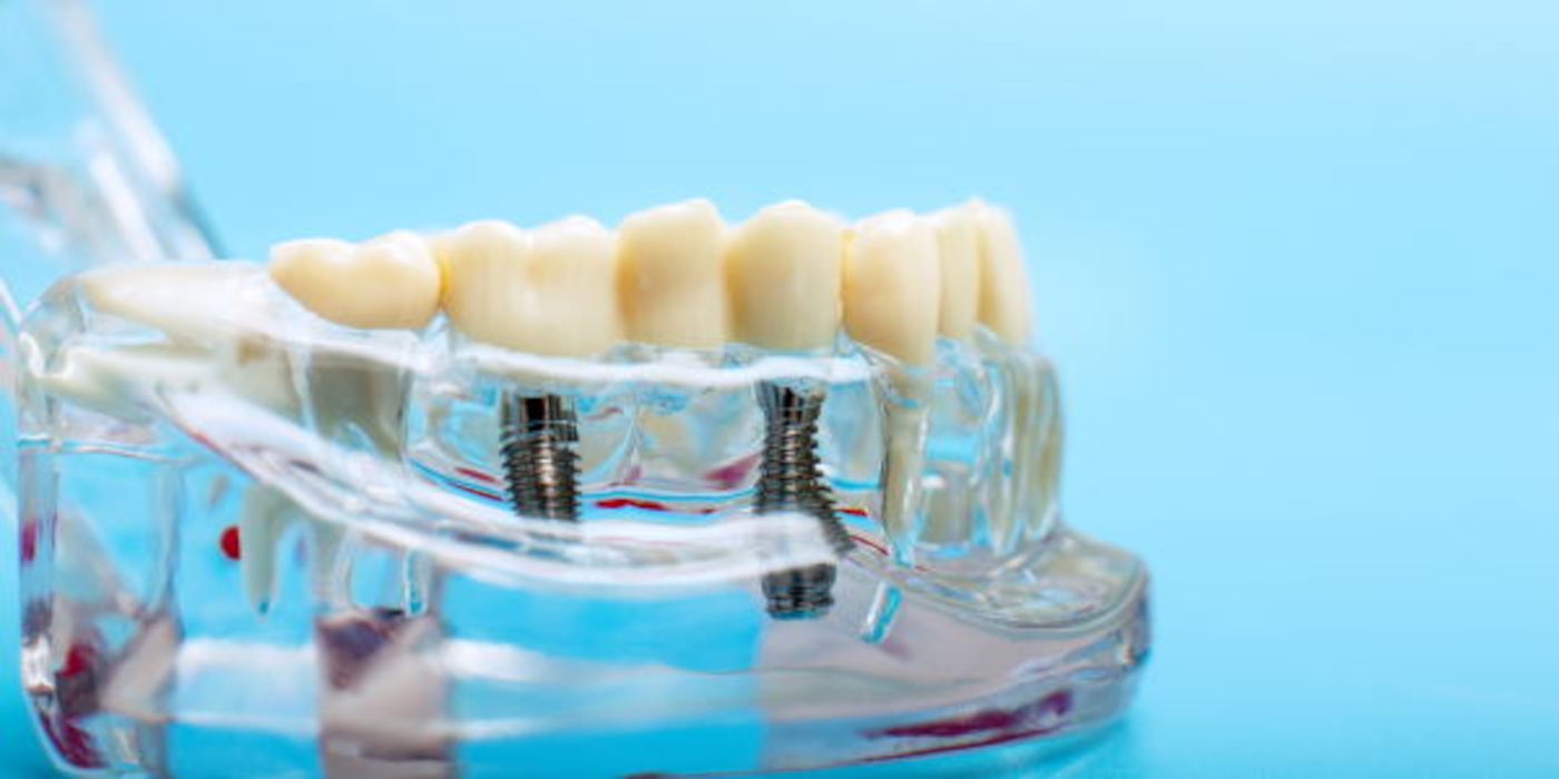 traitement orthodontique